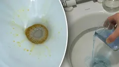 Keltaiset tahrat katoavat hetkessä: kaada tämä kotikonsti WC-pönttöön